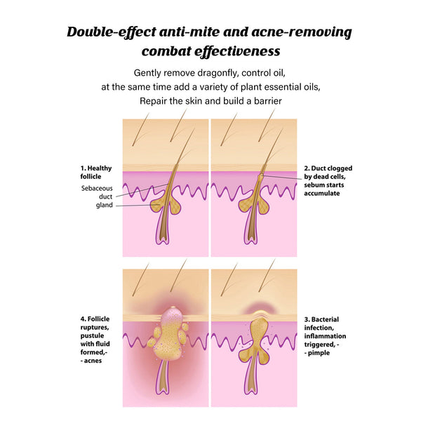 Clear Skin Mite Soap